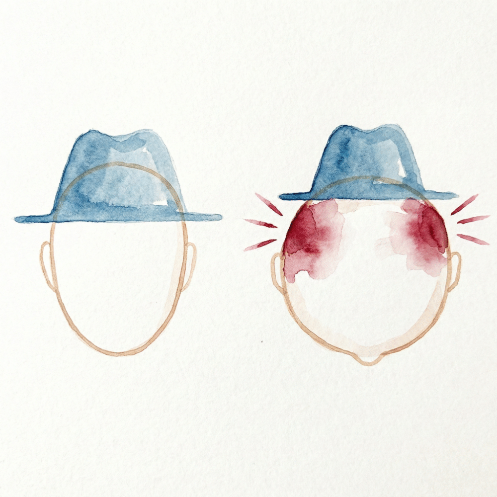 Diagram comparing an elongated oval Western head shape (left) with a rounder Japanese head shape (right), illustrating why foreign hats press at the temples